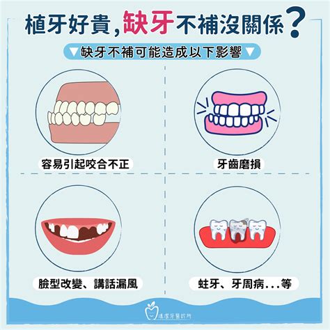 缺牙會漏財嗎|缺牙不補會怎樣？缺牙治療方式、原因、免補案例一次。